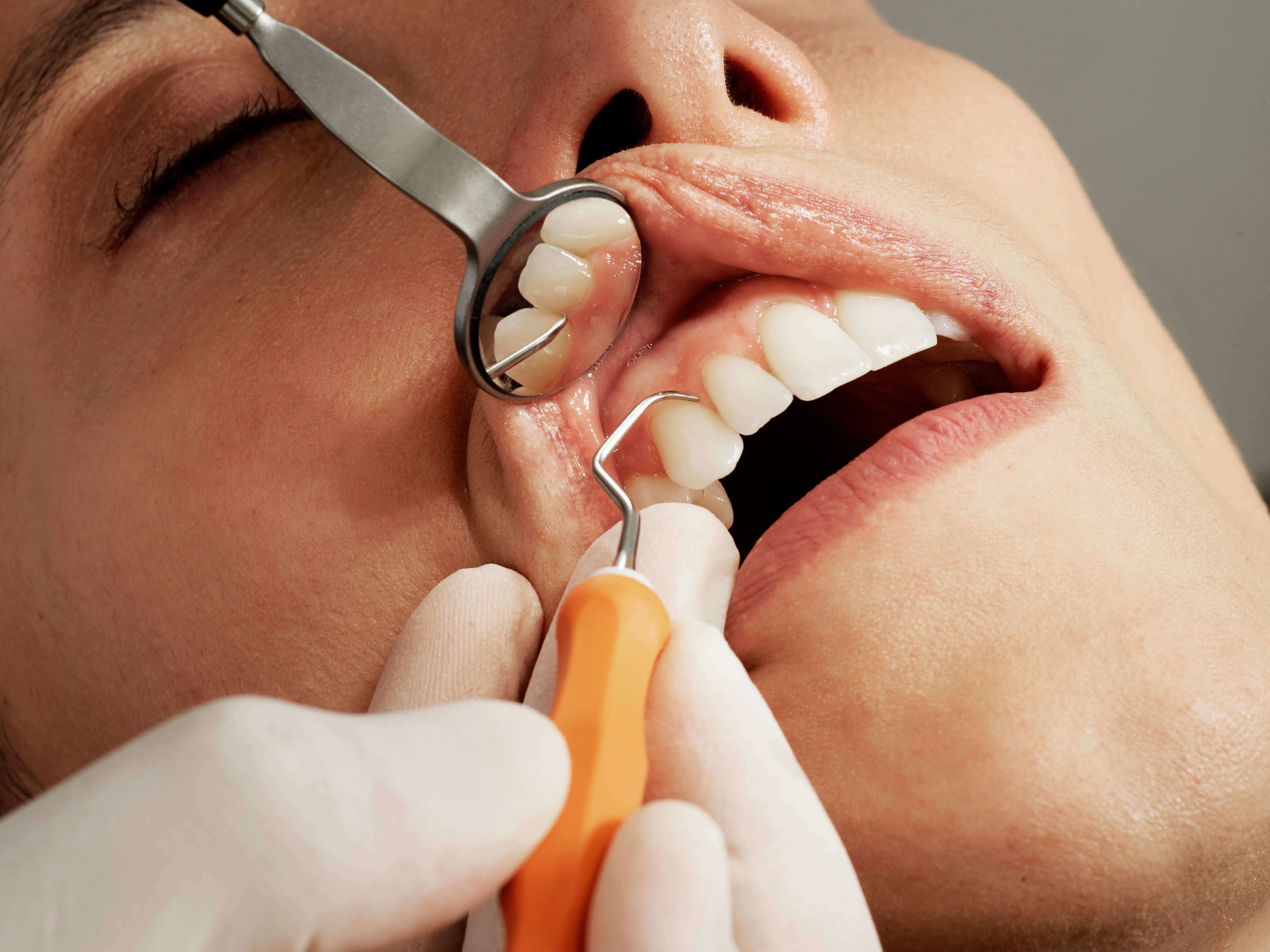 Teeth & braces Dental Care