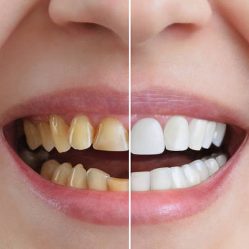 Cosmetic Dentistry Lucknow