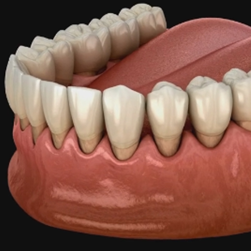 Gum disease treatment Lucknow