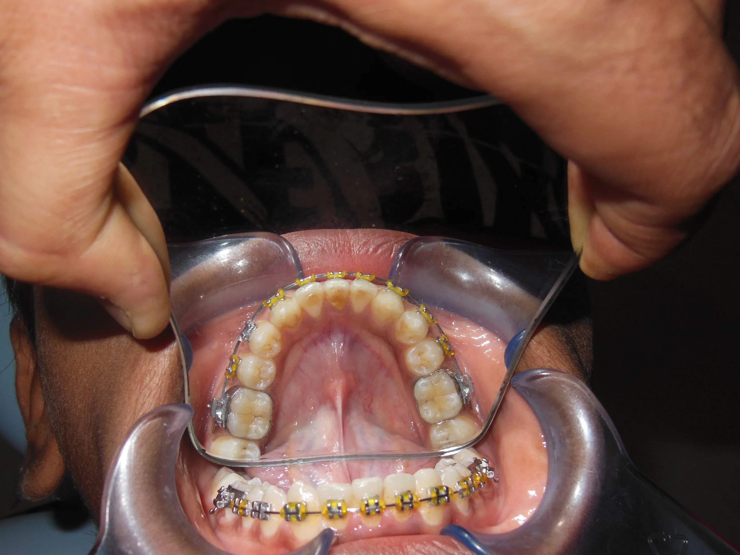 Case 2 — After Treatment