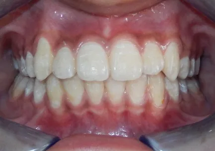 Case 3 — After Treatment