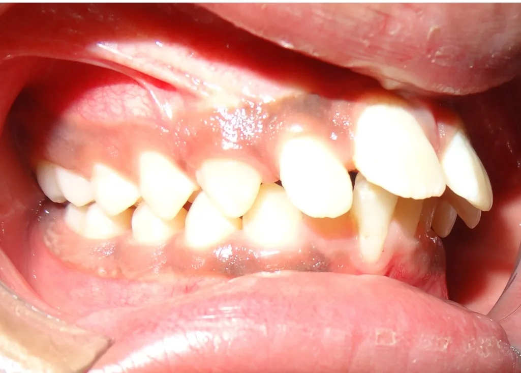 Case 1 — Before Treatment