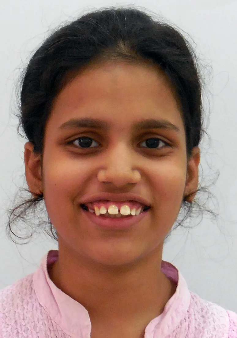 Case 7 — Before Treatment